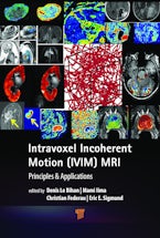 Intravoxel Incoherent Motion (IVIM) MRI